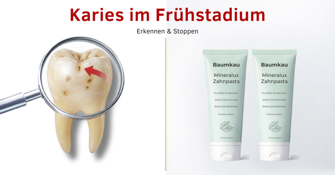 Karies im Frühstadium erkennen und stoppen: Was du jetzt tun kannst