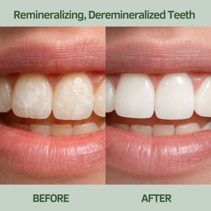 Baumkau - Remineralizing Gum