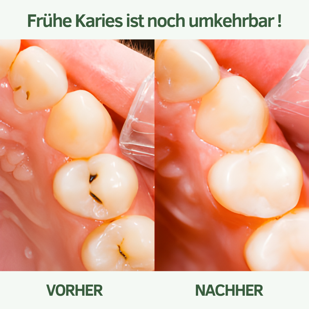 Baumkau - Täglicher Zahnpflege Kaugummi