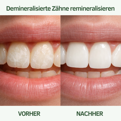 Baumkau - Täglicher Zahnpflege Kaugummi