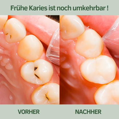 Baumkau - Remineralisierender Kaugummi