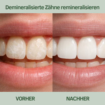 Baumkau - Remineralisierender Kaugummi